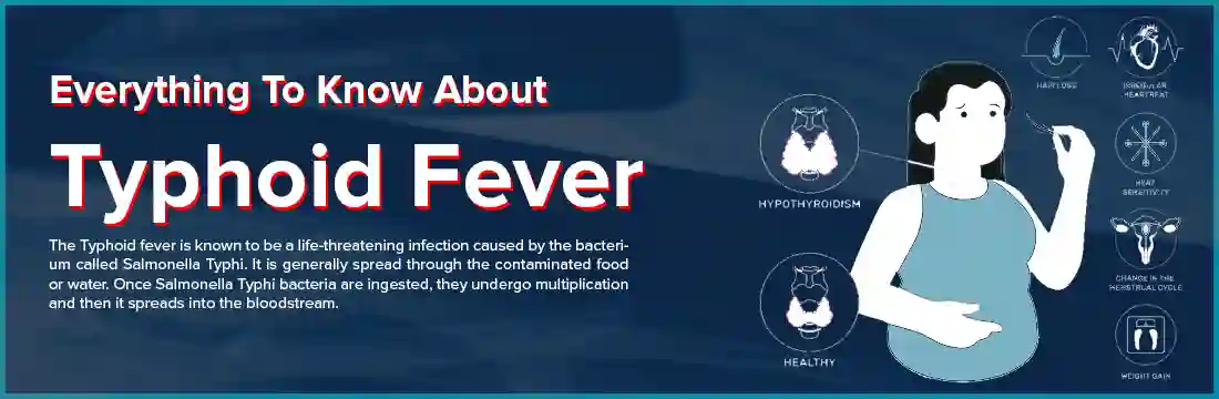 Everything To Know About Typhoid Fever